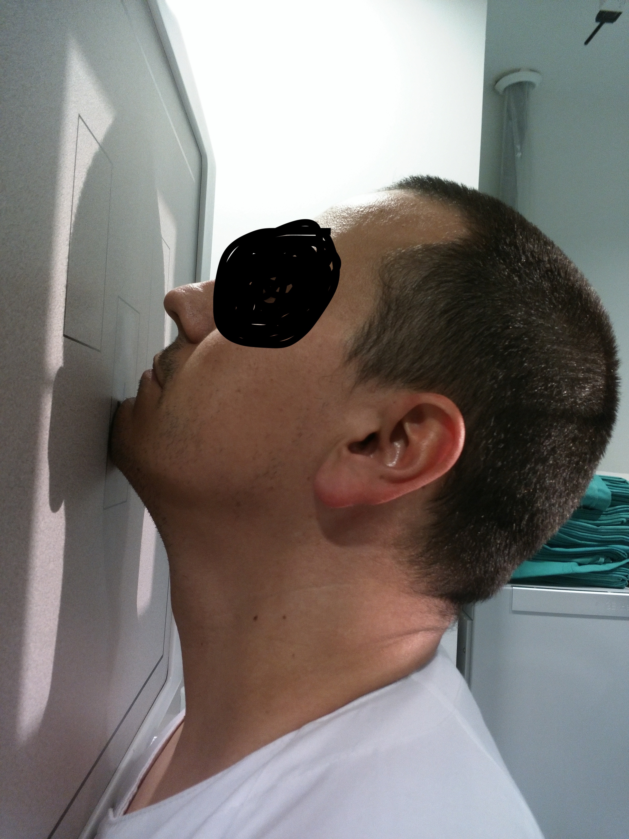 Proyección Axial Cráneo Towne